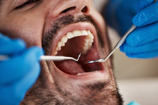 Dentist for Dental Trauma in PA